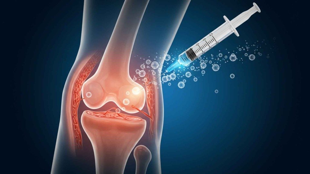 Ortopedik Kök Hücre Tedavisi Tedavisi ve Ameliyatı: A'dan Z'ye Rehber