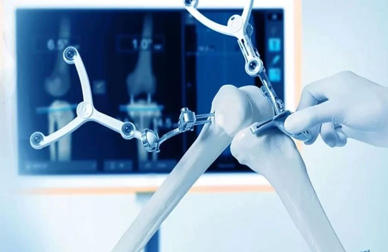 Robotik Cerrahi Karşılaştırma